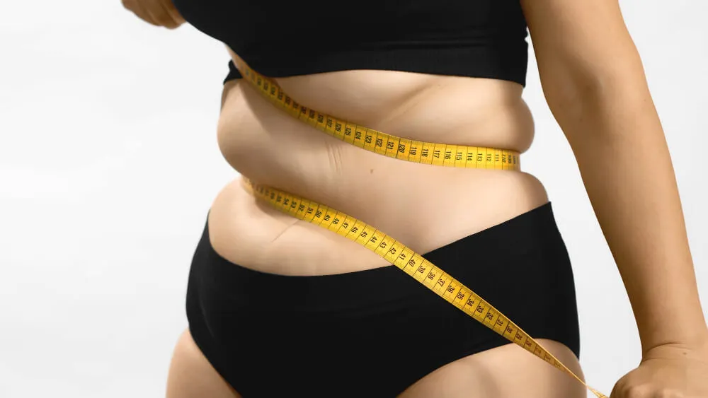 Gastric Plication