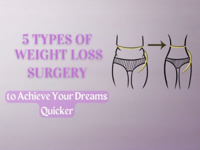 Types of Weight Loss Surgery