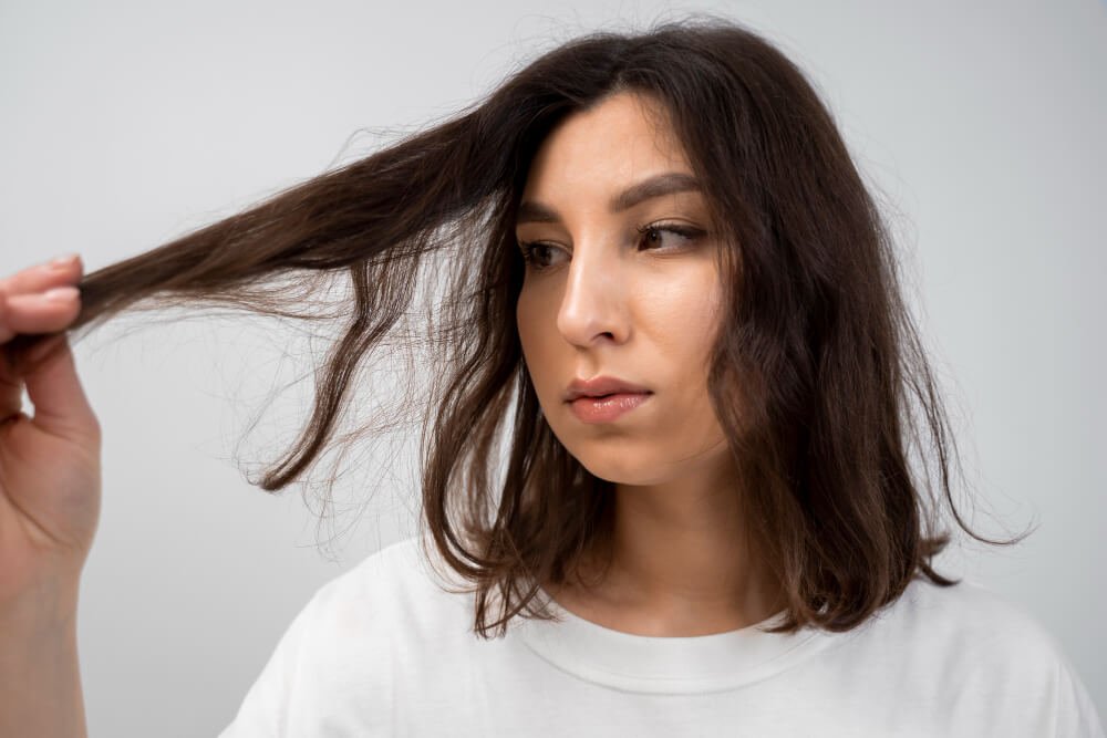 Hair Loss After Bariatric Surgery