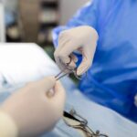 gastric sleeve scars
