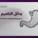 صورة معدة بجانبها الكلام الآتي: "بدائل التكميم: ما هي البدائل المتاحة بالنسبة لك؟"