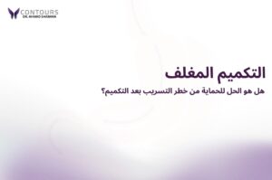 غلاف بخلفية بيضاء يحتوى على النص "التكميم المغلف"