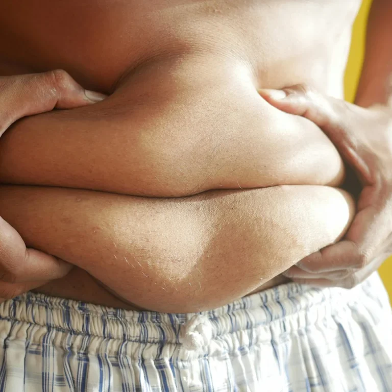 صورة رجل يمسك بطنه لمقالة ايهما افضل التكميم ام تحويل المسار المصغر