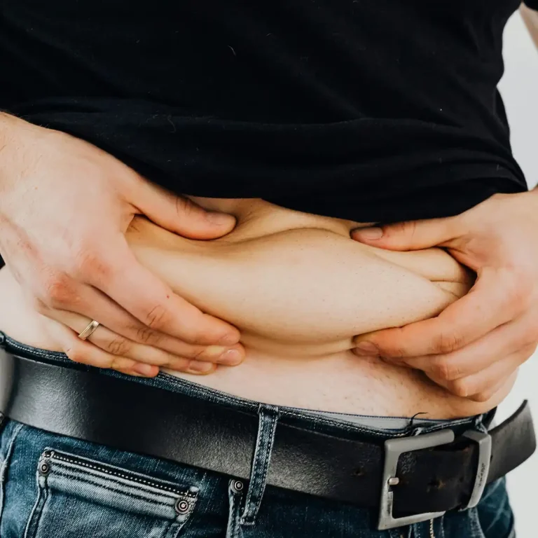 صورة رجل يعاني من زيادة في دهون البطن لمقالة عن نزول الكرش