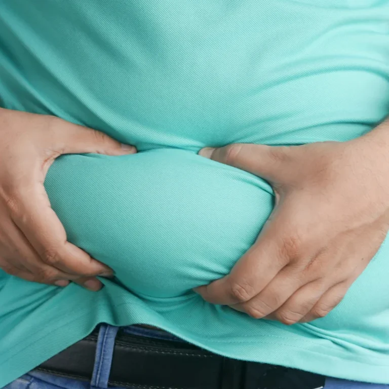 صورة شخص يعاني من زيادة في الوزن لمقالة الفرق بين تدبيس المعدة وتكميم المعدة